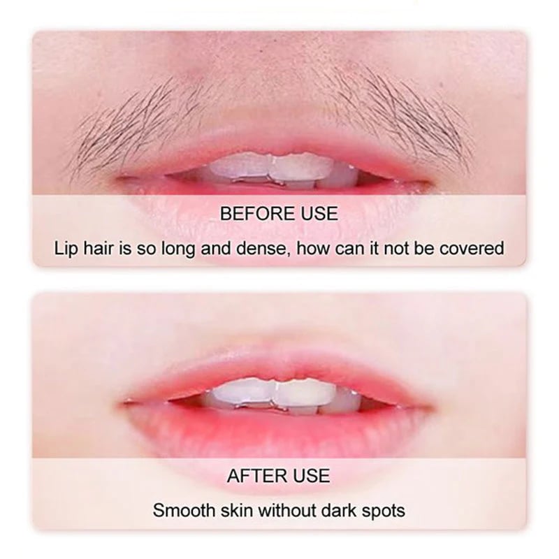 Gentle and Painless Facial Hair Removal Cream
