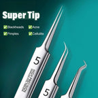 HOT SALE 49% OFF💥Professional Facial Blackhead Remover Tweezers