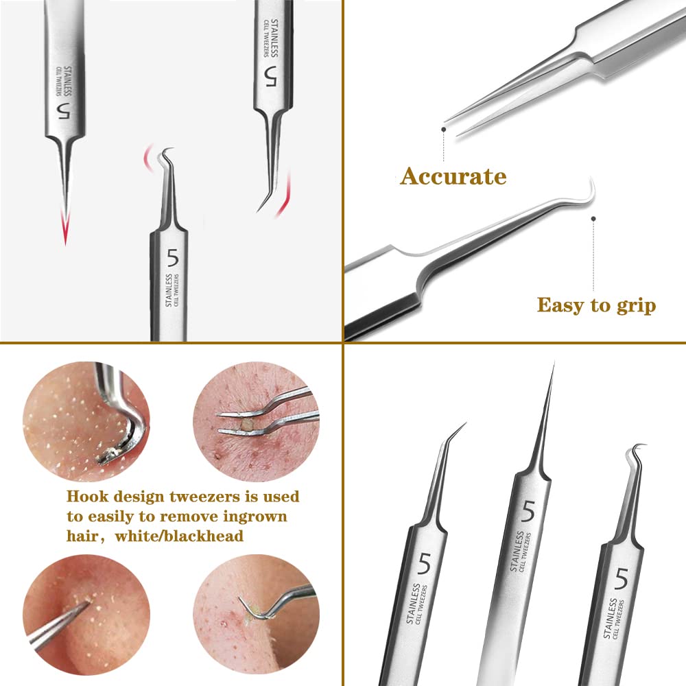 HOT SALE 49% OFF💥Professional Facial Blackhead Remover Tweezers