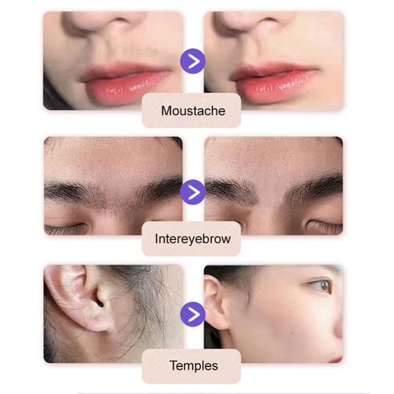 Gentle and Painless Facial Hair Removal Cream